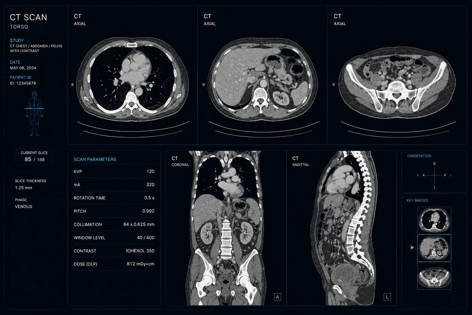 CT Scanner at National PET Scan Dade LLC